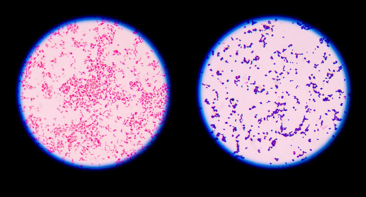 Bakterie Gram-dodatnie i Gram-ujemne – jak je rozróżnić?