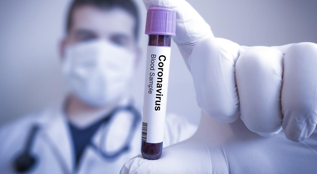 Prof. Religa: nawet bezobjawowe przechorowanie koronawirusa może pozostawić pewne symptomy