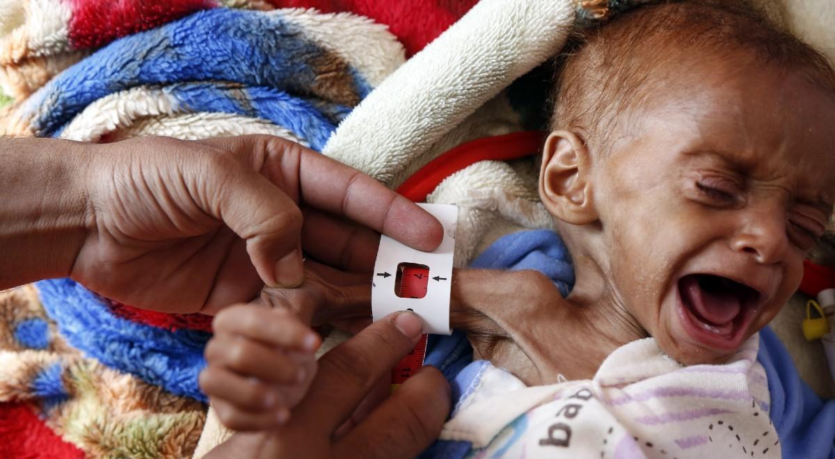 Polska Misja Medyczna apeluje o pomoc. Potrzebne jest jedzenie dla głodujących mieszkańców Jemenu