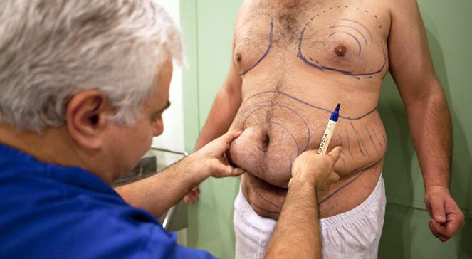 Ekspertka: Polacy zaczynają wyglądać bardzo niekorzystnie w kontekście nadwagi