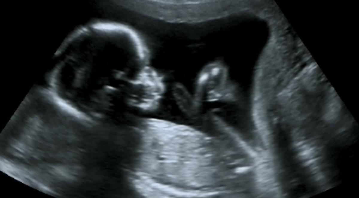Sąd Najwyższy USA debatuje ws. aborcji. Czy rozum zwycięży nad poprawnością polityczną?